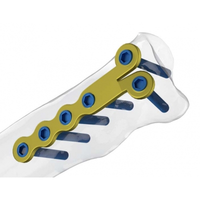 Mini Plak Seti (0-6 kg)